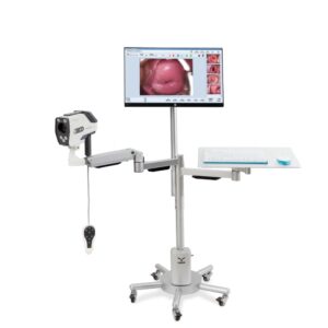 Colposcopio de Alta Definición para Diagnóstico Ginecológico